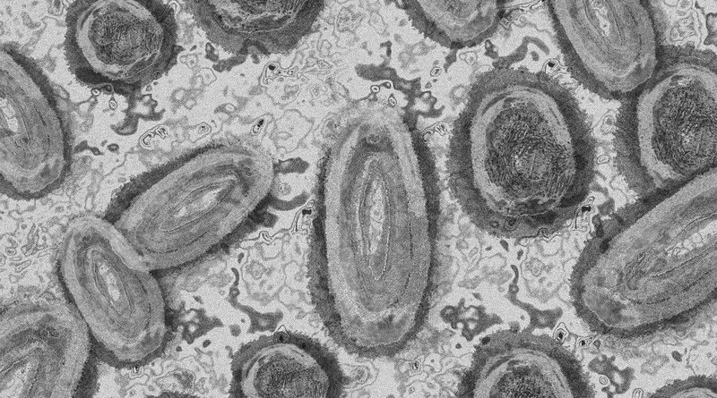 (Bild: Abstrakte Darstellung des Affenpocken-Virus)